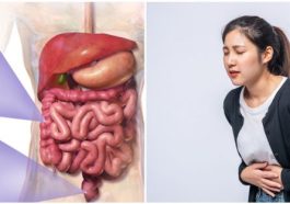 Kanker Usus Besar Meningkat di Usia Muda, Ini Faktornya