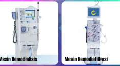 Hemodiafiltrasi, Cuci Darah Canggih untuk Penderita Gagal Ginjal