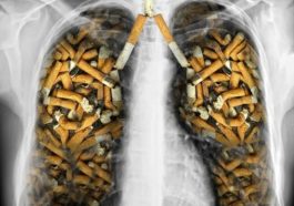 Jenis Rokok Tentukan Risiko dan Lokasi Kanker