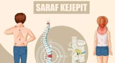 Saraf Terjepit Bisa Terjadi di Usia Muda, Cek Faktanya