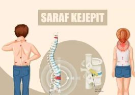 Saraf Terjepit Bisa Terjadi di Usia Muda, Cek Faktanya