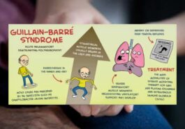 Guillain-Barré Syndrome Waspada Gejala Awalnya