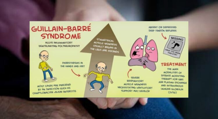 Guillain-Barré Syndrome Waspada Gejala Awalnya