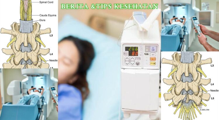 Kemoterapi Intratekal Cara Obati Kanker Otak & Tulang Belakang