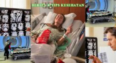 Kenali Glioma, Tumor Otak yang Diderita Kelley Mack