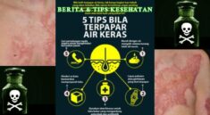 Luka Akibat Air Keras Cara Aman Tangani Terkena Siraman