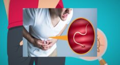 Cacingan pada Anak dan Dewasa Gejala dan Pengobatan