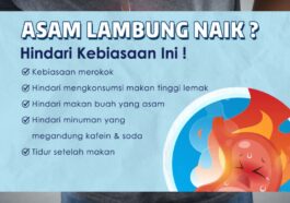 Cara Cepat Atasi Asam Lambung Naik di Rumah