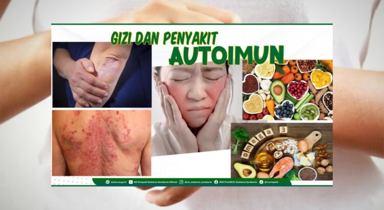 Deteksi Dini Autoimun Penting untuk Cegah Komplikasi
