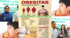 Kemenkes Atasi Obesitas Anak Sugar Tax Jadi Langkahnya