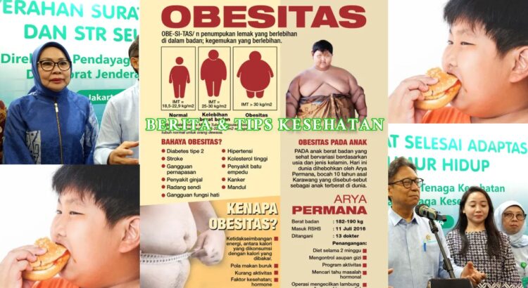 Kemenkes Atasi Obesitas Anak Sugar Tax Jadi Langkahnya
