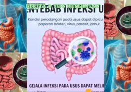 Parasit Usus Gejala Umum, Risiko, dan Pencegahan Efektif