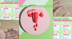 Perbedaan Keputihan Sebelum dan Sesudah Haid yang Normal