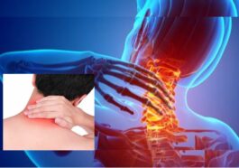 Ciri Asam Urat di Leher yang Perlu Kamu Waspadai