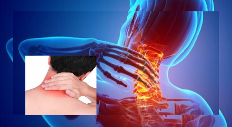 Ciri Asam Urat di Leher yang Perlu Kamu Waspadai