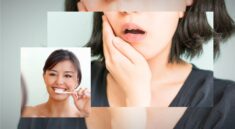 Masalah Kesehatan Gigi di Alami Mayoritas Warga Indonesia