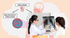 Penuntasan Kasus TBC Dukungan Kolaborasi Pusat dan Daera