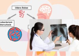 Penuntasan Kasus TBC Dukungan Kolaborasi Pusat dan Daera