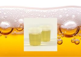 Penyebab Urine Berbusa dan Kaitannya dengan Kesehatan