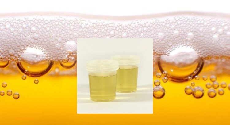 Penyebab Urine Berbusa dan Kaitannya dengan Kesehatan