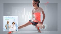 Terapi Stem Cell dan Secretome Bantu Pulihkan Tulang dan Sendi