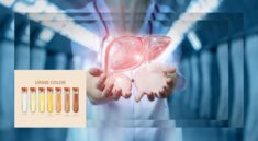 Ciri-Ciri Hati Rusak yang Terlihat dari Warna dan Bau Urine