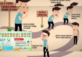 Ciri Tuberkulosis yang Perlu Anda Waspadai Sejak Awal
