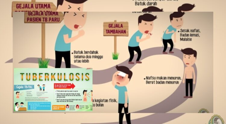 Ciri Tuberkulosis yang Perlu Anda Waspadai Sejak Awal