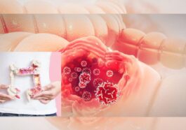 Kanker Kolorektal Serang Usia Muda, Ini Faktor Risikonya