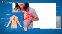 Tanda Serangan Jantung pada Perempuan yang Perlu Diwaspadai