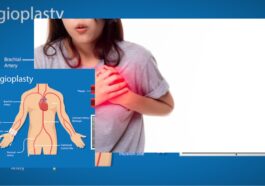 Tanda Serangan Jantung pada Perempuan yang Perlu Diwaspadai