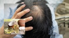 Tips Ampuh Cegah Rambut Rontok Secara Alami