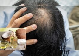 Tips Ampuh Cegah Rambut Rontok Secara Alami