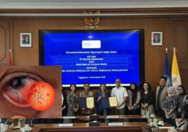 Upaya Indonesia Atasi Retinopati Diabetik dengan Teknologi Baru