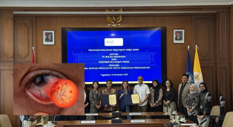 Upaya Indonesia Atasi Retinopati Diabetik dengan Teknologi Baru