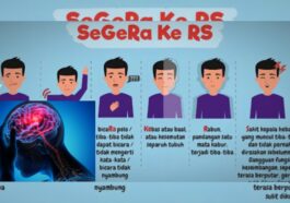 Waspadai Gejala Stroke yang Muncul Jauh Sebelum Serangan