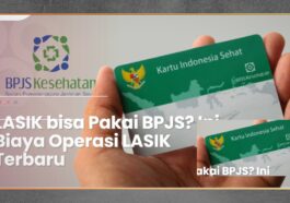 Biaya Operasi LASIK Terbaru dan Rinciannya