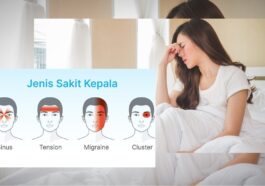 Cara Membedakan Sakit Kepala Biasa dan Migrain
