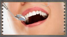 Gigi Goyang pada Dewasa Bisa Jadi Tanda Penyakit Gusi