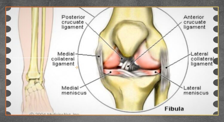 Ligamen Artifisial Jadi Solusi Baru Cedera Lutut
