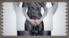 Cara Mencegah ISK agar Kesehatan Saluran Kemih Terjaga