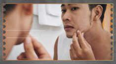 Masalah Kulit yang Paling Sering Dialami Pria Indonesia