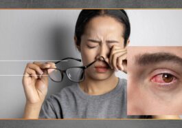 Mata Kering Mengganggu Aktivitas Ini Gejala dan Solusinya