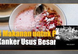 4 Makanan yang Membantu Cegah Risiko Kanker Usus Besar