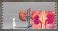 CKG Jadi Kunci Deteksi Dini Masalah Ginjal