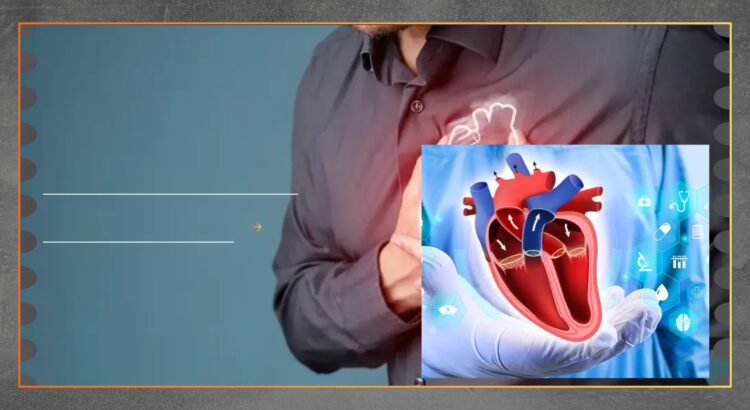 Gejala Awal Katup Aorta Menyempit yang Harus Diwaspadai