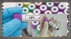 Tes HPV Mandiri Cara Mudah Deteksi Kanker Serviks