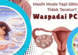 PCOS dan Haid Tidak Teratur, Kenali Gejalanya Sejak Dini