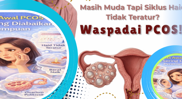 PCOS dan Haid Tidak Teratur, Kenali Gejalanya Sejak Dini