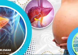 Obesitas Tingkatkan Risiko Lemak Hati dan Penyakit Kronis